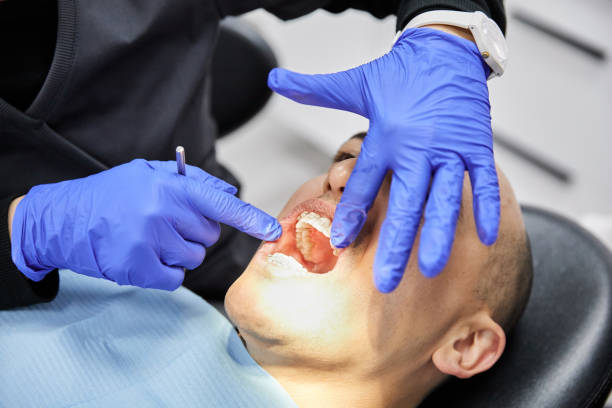 Teeth Whitening in GA
